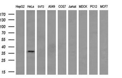 NHEJ1 Monoclonal Antibody (OTI3E5), TrueMAB , OriGene 30 &mu;L; Unconjugated:Antibodies,