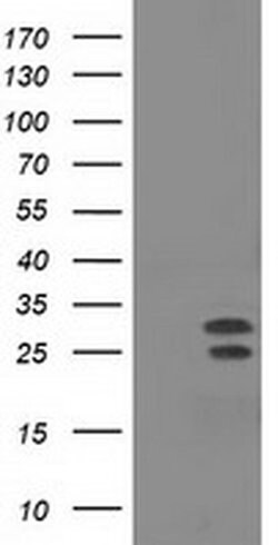 NHEJ1 Monoclonal Antibody (OTI1G7), TrueMAB , OriGene 100 &mu;L; Unconjugated:Antibodies,