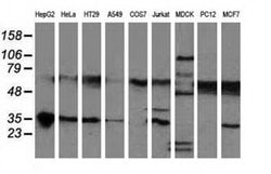 NHEJ1 Monoclonal Antibody (OTI1E2), TrueMAB , OriGene 30 &mu;L; Unconjugated:Antibodies,