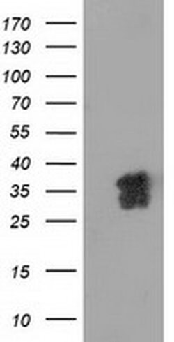 NHEJ1 Monoclonal Antibody (OTI1G5), TrueMAB , OriGene:Antibodies:Primary