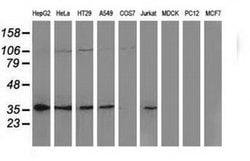 NHEJ1 Monoclonal Antibody (OTI1G5), TrueMAB , OriGene 100 &mu;L; Unconjugated:Antibodies,