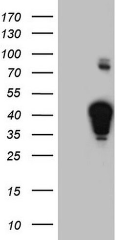 NHEJ1 Monoclonal Antibody (OTI1B5), TrueMAB , OriGene 30 &mu;L | Buy Online | Origene Technologies | Fisher Scientific