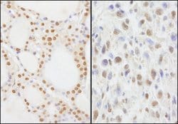 NIF1 Rabbit anti-Human, Mouse, Polyclonal, Bethyl Laboratories 10 &mu;l;