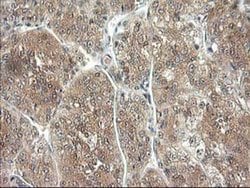 NIF3L1 Monoclonal Antibody (OTI2B7), TrueMAB , OriGene 100 &mu;L; Unconjugated:Antibodies,