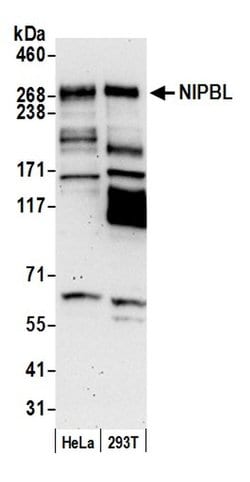 NIPBL Polyclonal Antibody, Bethyl Laboratories 20 &mu;L; Unconjugated:Antibodies,
