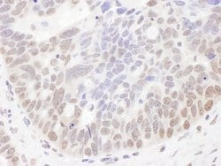 NIR Rabbit anti-Human, Polyclonal, Bethyl Laboratories 100 &mu;L; Unconjugated:Antibodies,