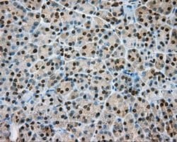 NIT1 Monoclonal Antibody (OTI3A11), TrueMAB , OriGene:Antibodies:Primary
