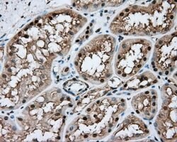 NIT1 Monoclonal Antibody (OTI3A11), TrueMAB , OriGene 100 &mu;L; Unconjugated:Antibodies,