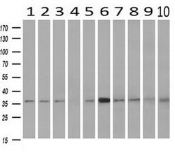 NIT1 Monoclonal Antibody (OTI3A11), TrueMAB , OriGene:Antibodies:Primary
