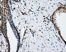 NIT2 Monoclonal Antibody (OTI6H7), TrueMAB , OriGene 30 &mu;L; Unconjugated:Antibodies,