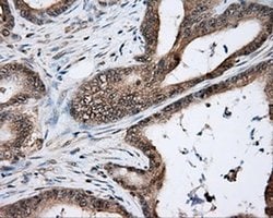 NIT2 Monoclonal Antibody (OTI6H7), TrueMAB , OriGene 30 &mu;L; Unconjugated:Antibodies,