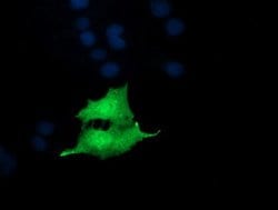 NKIRAS1 Mouse anti-Human, Clone: OTI6C11, lyophilized, TrueMAB 100 &mu;g;