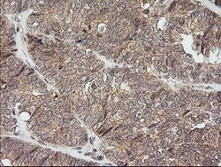 NKIRAS1 Mouse anti-Human, Clone: OTI6C11, lyophilized, TrueMAB 100 &mu;g;