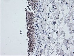 NKIRAS1 Mouse anti-Human, Clone: OTI6C11, lyophilized, TrueMAB 100 &mu;g;