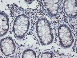 NKIRAS1 Mouse anti-Human, Clone: OTI6C11, lyophilized, TrueMAB 100 &mu;g;