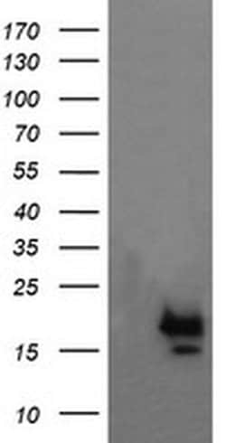 NKIRAS1 Monoclonal Antibody (OTI1D2), TrueMAB , OriGene:Antibodies:Primary