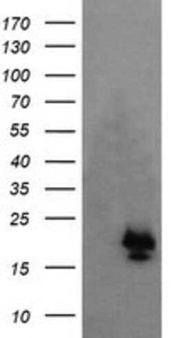 NKIRAS1 Mouse anti-Human, Clone: OTI6C11, lyophilized, TrueMAB 100 &mu;g;