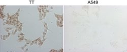 NKX2 Monoclonal Antibody (OTI13H3), TrueMAB , OriGene 100 &mu;L; Unconjugated:Antibodies,