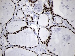 NKX2 Monoclonal Antibody (OTI1C5), TrueMAB , OriGene 100 &mu;L; Unconjugated:Antibodies,