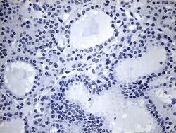 NKX2 Mouse anti-Human, Clone: OTI1C5, lyophilized, TrueMAB 100 &mu;g; Unconjugated:Antibodies,