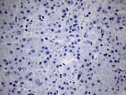 NKX2 Mouse anti-Human, Clone: OTI1C5, lyophilized, TrueMAB 100 &mu;g; Unconjugated:Antibodies,