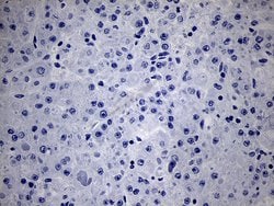 NKX2 Monoclonal Antibody (OTI1C5), TrueMAB , OriGene 100 &mu;L; Unconjugated:Antibodies,