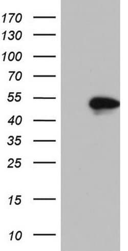 NKX2 Monoclonal Antibody (OTI2H10), TrueMAB , OriGene:Antibodies:Primary