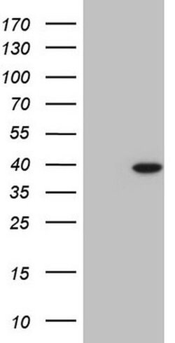 NKX2 Monoclonal Antibody (OTI3F3), TrueMAB , OriGene 100 &mu;L; Unconjugated:Anticuerpos