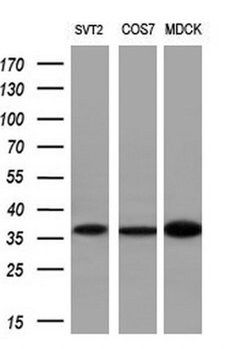 NKX2 Monoclonal Antibody (OTI3F3), TrueMAB , OriGene 100 &mu;L; Unconjugated:Anticuerpos