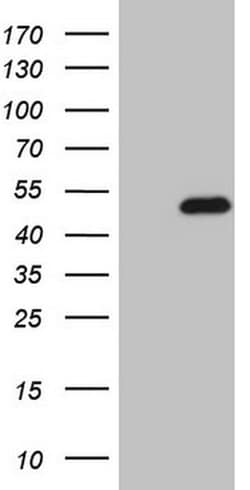 NKX2 Monoclonal Antibody (OTI13H3), TrueMAB , OriGene 100 &mu;L; Unconjugated:Antibodies,