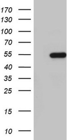 NKX2 Mouse anti-Human, Clone: OTI13F3, lyophilized, TrueMAB 100 &mu;g;
