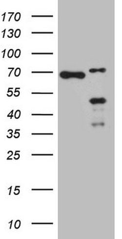 NKX2 Mouse anti-Human, Clone: OTI8E2, lyophilized, TrueMAB 100 &mu;g; Unconjugated:Antibodies,
