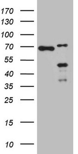 NKX2 Monoclonal Antibody (OTI8E2), TrueMAB , OriGene:Antibodies:Primary