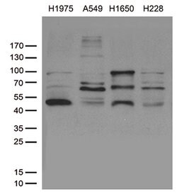 NKX2 Monoclonal Antibody (OTI1C5), TrueMAB , OriGene 100 &mu;L; Unconjugated:Antibodies,
