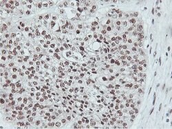 NLN Monoclonal Antibody (OTI1B8), TrueMAB , OriGene 30 &mu;L; Unconjugated:Antibodies,