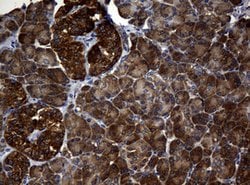 NME1 Mouse anti-Human, Clone: OTI2D8, lyophilized, TrueMAB 100 &mu;g; Unconjugated:Antibodies,
