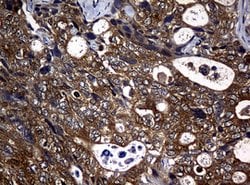 NME1 Mouse anti-Human, Clone: OTI2D8, lyophilized, TrueMAB 100 &mu;g; Unconjugated:Antibodies,