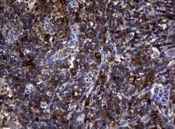 NME1 Mouse anti-Human, Clone: OTI2D8, lyophilized, TrueMAB 100 &mu;g; Unconjugated:Antibodies,