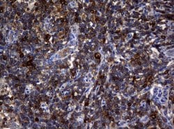 NME1 Monoclonal Antibody (OTI2D8), TrueMAB , OriGene 100 &mu;L; Unconjugated:Antibodies,