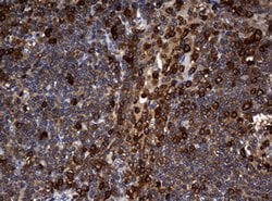 NME1 Mouse anti-Human, Clone: OTI2D8, lyophilized, TrueMAB 100 &mu;g; Unconjugated:Antibodies,