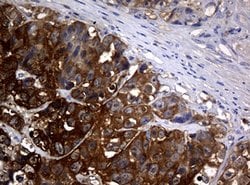 NME1 Mouse anti-Human, Clone: OTI2D8, lyophilized, TrueMAB 100 &mu;g; Unconjugated:Antibodies,
