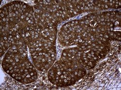 NME1 Monoclonal Antibody (OTI2A5), TrueMAB , OriGene 100 &mu;L; Unconjugated:Antibodies,