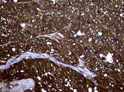 NME1 Monoclonal Antibody (OTI2A5), TrueMAB , OriGene 100 &mu;L; Unconjugated:Antibodies,