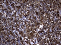 NME1 Monoclonal Antibody (OTI2A5), TrueMAB , OriGene 100 &mu;L; Unconjugated:Antibodies,