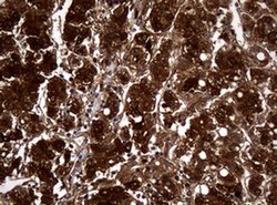 NME1 Monoclonal Antibody (OTI2A5), TrueMAB , OriGene 100 &mu;L; Unconjugated:Antibodies,