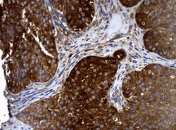 NME1 Monoclonal Antibody (OTI7D6), TrueMAB , OriGene 100 &mu;L; Unconjugated:Antibodies,
