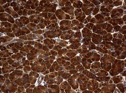 NME1 Monoclonal Antibody (OTI7D6), TrueMAB , OriGene:Antibodies:Primary