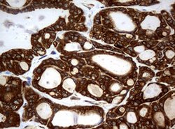 NME1 Monoclonal Antibody (OTI7D6), TrueMAB , OriGene 100 &mu;L; Unconjugated:Antibodies,