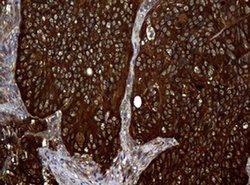 NME1 Monoclonal Antibody (OTI7D6), TrueMAB , OriGene 100 &mu;L; Unconjugated:Antibodies,