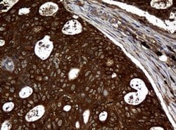 NME1 Monoclonal Antibody (OTI7D6), TrueMAB , OriGene:Antibodies:Primary